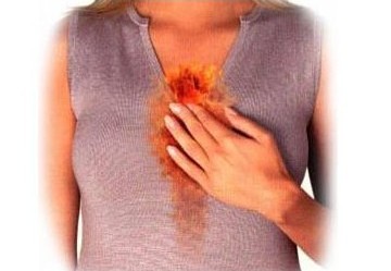 Reflusso gastroesofageo: sintomi, cura e rimedi consigliati