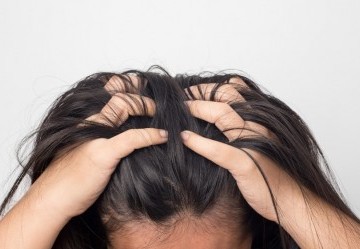 Tricodinia: cause e rimedi del dolore al cuoio capelluto