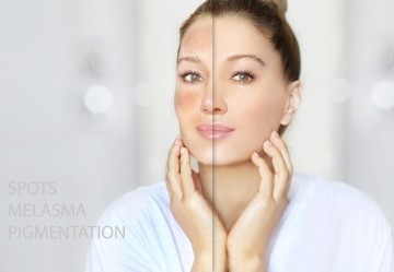 Macchie senili: cause, rimedi naturali e trattamenti dermatologici