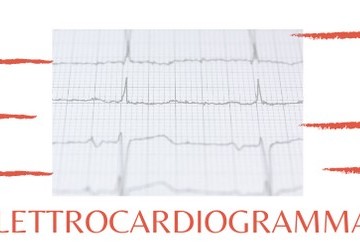 Elettrocardiogramma