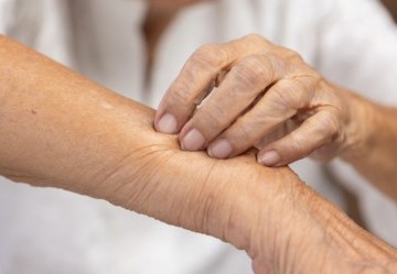 Tutti i rimedi per la pelle disidratata e pruriginosa Tutti i rimedi per la pelle disidratata e pruriginosa