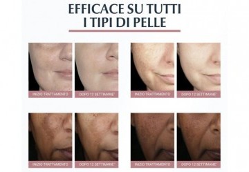 Eucerin Anti-Pigment: Una Rivoluzione contro le Macchie Cutanee Eucerin Anti-Pigment: Una Rivoluzione contro le Macchie Cutanee