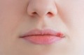 Come combattere l'herpes labiale