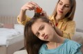 Pediculosi: come risconoscere ed eliminare i pidocchi